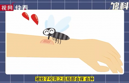 被蚊子叮咬后會越撓越癢嗎？