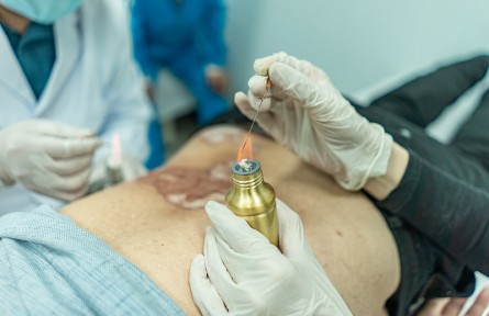 科技名詞|火針療法 fire needle therapy；puncturing point with hot-red needle