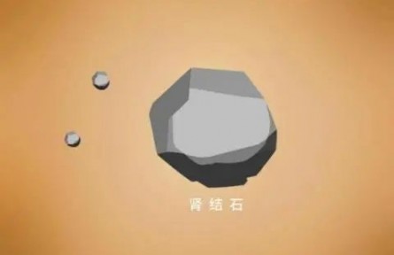 辟謠|腎結(jié)石患者不能補(bǔ)鈣？菠菜燉豆腐都不能吃了？