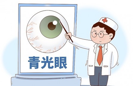 科技名詞|青光眼 glaucoma
